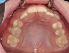 Hailey W. - 8 months into treatment