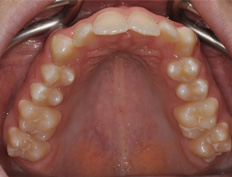Austin C. - 5 months into treatment