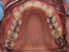 Kevin J. - 5 weeks into treatment