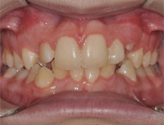 Sammy B. - 8 months into treatment