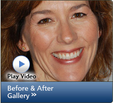 Before and After Video